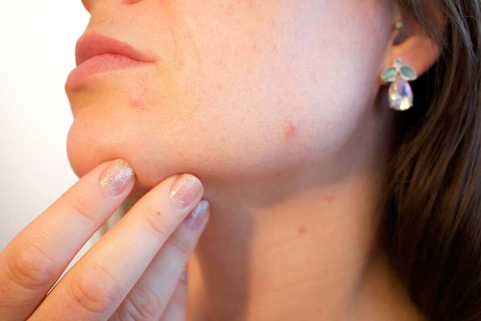 5 Skincare Benefits from your Steam Bath to Look Forward to